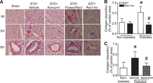 FIG. 4. Role of Rac1/NADPH oxidase in myocardial fibrosis. Diabetes was induced by injection of STZ in Rac1-ko mice and their WT littermates. In a separate experiment, WT diabetic mice were treated with vehicle or apocynin in drinking water for 2 months. The hearts were fixed, embedded, and sectioned. Sections of heart were stained with hematoxylin and eosin and a saturated solution of picric acid containing 1% Sirius red for collagen deposition (see research design and methods). A: Representative staining for collagen deposition is presented for intra-myocardium (IM), small vessel (SV), and big vessel (BV) from each group. Collagen deposition is stained as red color. B and C: Collagen deposition was quantified as percent of cardiac area. Data are means ± SD, n = 6–8. *P < 0.05 vs. nondiabetes in WT or vehicle; #P < 0.05 vs. diabetes in WT or vehicle. (A high-quality digital representation of this figure is available in the online issue.)