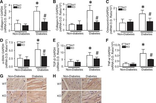 FIG. 5. Effect of Rac1 knockout on pro-fibrotic genes expression. Diabetes was induced by injection of STZ in Rac1-ko (KO) and their WT littermates. Two months after STZ injection, the mRNA levels of Col I (A), Col III (B), osteopontin (C), α-SMA (D), TGF-β1 (E), and TNF-α (F) were quantified in heart tissues by real-time RT-PCR. G and H: Representative immunohistological stainings for TGF-β1 (G) and TNF-α (H) from four to six different hearts in each group (yellow-brown signal). Magnification ×40. Data are means ± SD, n = 6–8. *P < 0.05 vs. nondiabetes in WT; #P < 0.05 vs. diabetes in WT. O.D., optical density. (A high-quality digital representation of this figure is available in the online issue.)