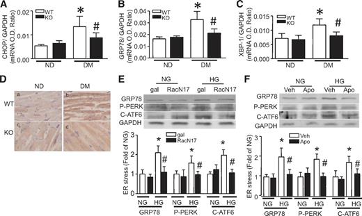 FIG. 7. Effect of Rac1 knockout on ER stress induction. Diabetes was induced by injection of STZ in Rac1-ko (KO) and their WT littermates. Two months after STZ injection, the mRNA levels of CHOP (A), GRP78 (B), and XBP1 (C) were quantified in heart tissues by real-time RT-PCR. D: GRP78 protein was also determined by immunohistological staining (yellow-brown signal). Magnification ×40. Data are means ± SD, n = 6–8. *P < 0.05 vs. nondiabetes (ND) in WT; #P < 0.05 vs. diabetes (DM) in WT. Cultured adult rat cardiomyocytes were infected with Ad-RacN17 (RacN17) or Ad-gal (gal) and then incubated with normal glucose (NG, 5.5 mmol/l) or high glucose (HG, 33 mmol/l) for 24 h. In a separate experiment, cardiomyocytes were incubated with normal or high glucose in the presence of apocynin (Apo) or vehicle (Veh) for 24 h. Western blot was performed for detection of phosphorylated PERK, cleaved ATF-6, GRP78, and GAPDH protein. Infection of Ad-RacN17 (E) and apocynin administration (F) reduced phosphorylated PERK, cleaved ATF-6, and GRP78 protein. The top panel is the representative blot from at least three different cell cultures and the lower panel is the quantification of phosphorylated PERK, cleaved ATF-6, and GRP78 protein. Data are means ± SD, n = 3–4. *P < 0.05 vs. gal or Veh in NG; #P < 0.05 vs. gal or Veh in HG. O.D., optical density. (A high-quality digital representation of this figure is available in the online issue.)
