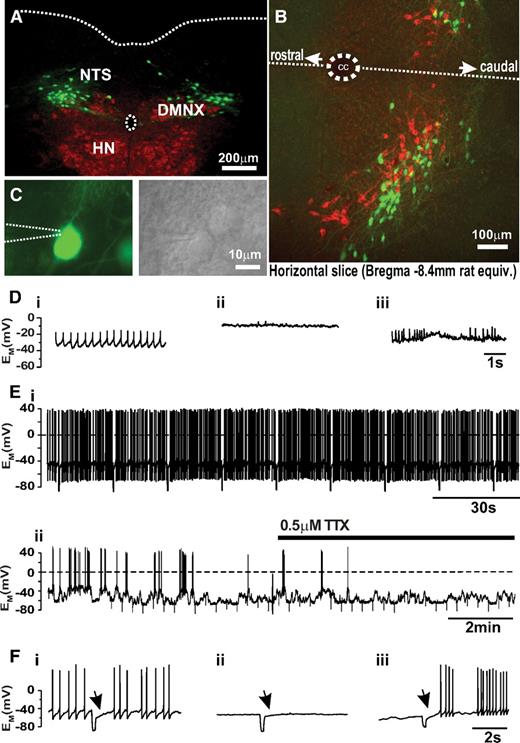 FIG. 1. Basic properties of PPG neurons of the NTS. A: Photomicrograph showing the location of PPG-Venus neurons (green fluorescence) in relation to the cholinergic (red fluorescence) dorsal vagal nucleus (DMNX) and hypoglossal nucleus (HN) in a 30-μm coronal brainstem slice at position Bregma −7.75 mm. The central canal and the dorsal border of the brainstem are indicated by dotted lines. B: Horizontal brainstem slice demonstrating the catecholaminergic cells (red fluorescence signifying anti-TH immunoreactivity) and PPG cells (green fluorescence) are two completely distinct cell populations that occupy overlapping areas of the NTS. The dotted line indicates the midline. CC, central canal. Confocal analysis of selected regions from these slices suggests that there is no direct contact between TH-positive and PPG cells (data not shown). C: Individual PPG neurons were identified by Venus fluorescence (top, patch pipette position indicated by dotted lines) and recordings were established under DIC illumination (bottom). D: In the cell-attached configuration while waiting for perforation, the firing phenotype of the neuron was observed: i, regular firing; ii, silent; iii, burst firing. E: Typical perforated-patch current-clamp recordings from regular firing neuron (i) and burst firing cell (ii). The fluctuations in membrane potential underlying the burst firing behavior persisted in TTX. F: injection of a −40 pA current pulse for 200 ms elicited an A-type K+ current (arrow) upon termination of the pulse in all three cell types. (A high-quality digital representation of this figure is available in the online issue.)