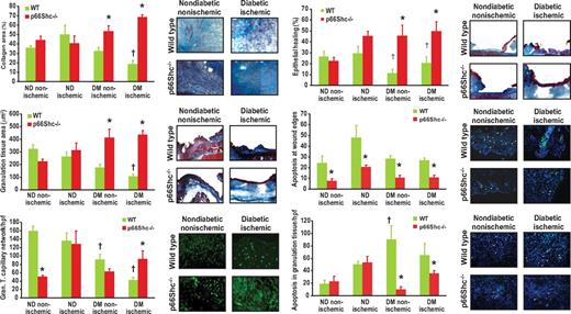 FIG. 2. Characteristics of the granulation tissue in SV129 mice. Several morphological characteristics of the granulation tissue were evaluated in WT and p66Shc knockout (KO), diabetic (DM) (4-week duration), and nondiabetic (ND) mice with or without hind limb ischemia. Masson trichrome staining allowed determination of collagen area and granulation tissue thickness. Reepithelialization was quantified in histological sections by measuring the percentage of re-covered epithelial gap. Capillary density within the granulation tissue was quantified by B4 isolectin immunofluorescence. Apoptosis was assessed with the ApopTag kit in the granulation tissue and at wound edges, a critical site for active wound healing. Representative images are shown for control (nondiabetic nonischemic) and diabetic ischemic WT and KO mice. n ≥ 3 mice for each group; n ≥ 5 sections for tissue samples. *P < 0.05 in KO vs. corresponding WT group. †P < 0.05 in diabetic vs. corresponding nondiabetic group. (A high-quality digital representation of this figure is available in the online issue.)