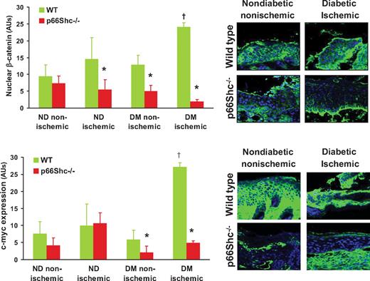 FIG. 3. Biomarkers of epithelial healing. In the epidermis, nuclear localization of β-catenin and high expression of c-myc, as features on nonhealing wounds, were quantified by immunofluorescence in wild-type (WT) and p66Shc -knockout (KO) diabetic (DM) and nondiabetic (ND) mice with or without hind limb ischemia. Representative images are shown for control (nondiabetic nonischemic) and diabetic ischemic WT and KO mice. n ≥ 3 mice for each group; n ≥ 5 sections for tissue samples. *P < 0.05 in KO vs. corresponding WT group. †P < 0.05 in diabetic vs. corresponding nondiabetic group. (A high-quality digital representation of this figure is available in the online issue.)