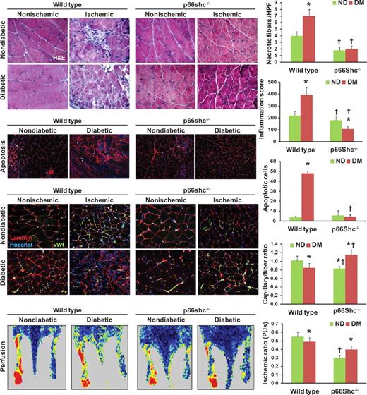 FIG. 6. Skeletal muscle damage and repair. Several morphological characteristics of skeletal muscle were evaluated in wild-type (WT) and p66Shc knockout (KO) diabetic (DM) and nondiabetic (ND) mice before and after hind limb ischemia. Hematoxylin and eosin staining was used to evaluate necrosis and to quantify inflammatory infiltrate. Apoptosis was quantified using the ApopTag assay kit while the capillary network was stained and quantified using double immunofluorescence for basement membrane (anti–α-laminin) and endothelium (anti-GSL I-isolectin B4). Limb perfusion was monitored 2 weeks after ischemia using a laser-doppler imager. Representative figures from the different groups of animals are shown. Histograms report ischemic versus nonischemic rations. n ≥ 3 experiments for each condition; n = 5 sections for each tissue sample. *P < 0.05 in DM vs. ND; †P < 0.05 in KO vs. WT. (A high-quality digital representation of this figure is available in the online issue.)