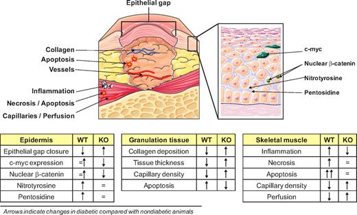 FIG. 7. Wound healing. The many differences in wound healing features between wild-type (WT) and p66Shc knockout (KO) mice are shown. The figure identifies single features, and the arrows in the tables indicate changes in diabetic compared with nondiabetic mice. (A high-quality digital representation of this figure is available in the online issue.)