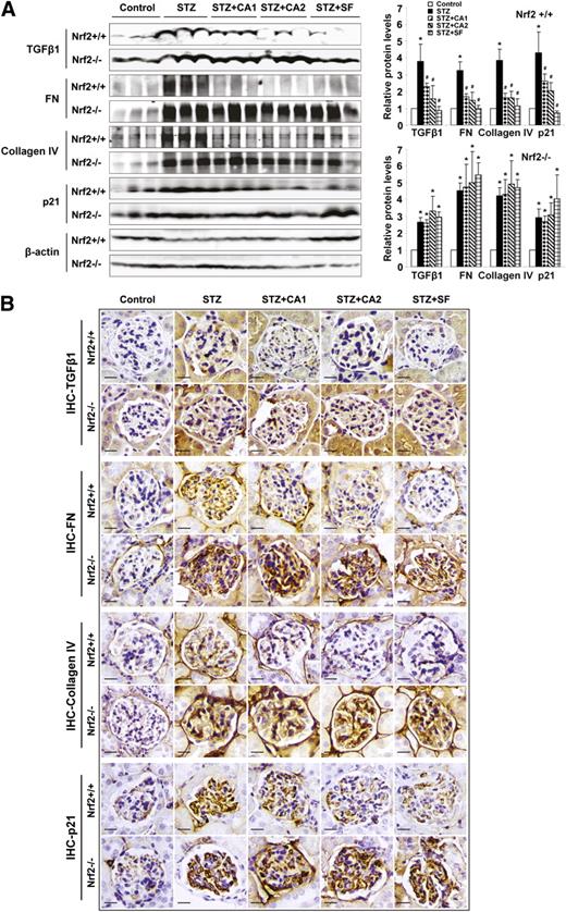 FIG. 4. Activation of Nrf2 reduces TGF-β1, ECM deposition, and p21 expression. A: Immunoblot analysis was performed on lysates from whole kidney (left panel), and band intensities were quantified (right panel, bar graphs) and reported as relative expression to control animals. STZ injection increased TGF-β1, FN, collagen IV, and p21 expression. Treatment with SF and CA reduced this expression in Nrf2+/+ only. B: Fixed kidney tissue was analyzed by IHC. STZ injection increased staining of the glomeruli for TGF-β1, FN, collagen IV, and p21. Treatment with SF and CA reduced expression of TGF-β1, FN, collagen IV, and p21 in Nrf2+/+ only. Data are expressed as mean ± SD (n = 3). *P < 0.05 compared with control. #P < 0.05 dietary treatment compared with STZ alone. (A high-quality color representation of this figure is available in the online issue.)