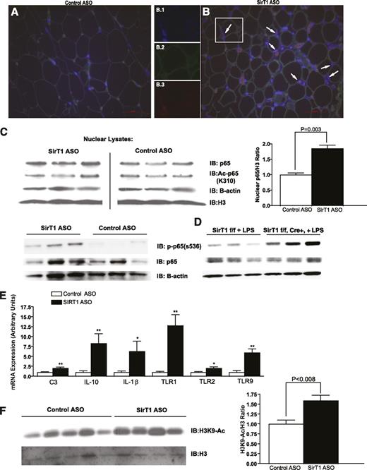 FIG. 3. SirT1 knockdown in WAT results in NF-κB nuclear localization and gene expression through reduction of H3K9 deacetylation. A and B: Representative (n = 5/group) images showing that SirT1 knockdown stimulates nuclear translocation of NF-κB in rat WAT. Adipocytes are stained for caveolin (green) and NF-κB p65 nuclear localization sequence (red). Nuclei are stained with DAPI (blue). Inset box is expanded to individual channels in B.1-B.3 to demonstrate NF-κB and DAPI colocalization. Some NF-κB–positive nuclei (arrows) are in adipocytes. Because the nuclear localization sequence is masked in the cytosol, nonnuclear staining is nonspecific (i.e., erythrocyte or other autofluorescence). C: SirT1 knockdown increases abundance of phosphorylated (Ser536) and total p65 in rat WAT nuclear lysates. Line separates noncontiguous lanes from the same blot. D: Chow-fed fat-specific SirT1 knockout mice have increased phospho-p65 in WAT ∼12 h after stimulation with LPS (50 μg i.p.). E: SirT1 knockdown increases adipose tissue cytokine, complement, and TLR mRNA expression (n = 5–7/group). *P < 0.05, **P < 0.01. F: SirT1 knockdown increases H3K9 acetylation. (A high-quality digital representation of this figure is available in the online issue.)