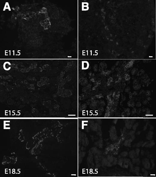 FIG. 1. Immunohistochemistry showing the ontogeny of GIP ligand (A, C, and E) and GIPR (B, D, and F). GIP ligand is present in the early embryonic pancreas, and the expression increases during late gestational ages. GIPR expression was weak at early ages, but strong expression was found at later gestational ages (magnification size bars: A and B = 20 μmol/L; C and D = 50 μmol/L; E and F = 100 μmol/L).