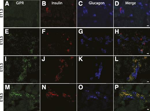 FIG. 3. Immunohistochemical staining for GIPR at serial gestational ages E11.5 (A–D), E13.5 (E–H), E15.5 (I–L), and E18.5 (M–P). Definite GIPR-positive staining was first identified at E13.5 and continued through E18.5 (A, E, I, and M). Insulin (B, F, J, and N), glucagon (C, G, K, and O), and merged images (D, H, L, and P) are shown. GIPR expression overlapped primarily with insulin. At E13.5, a few glucagon cells also expressed GIPR (compare 3D and 3H) in addition to the insulin-positive cells that expressed GIPR (magnification size bars: D and H = 20 μmol/L; L and P = 50 μmol/L). (A high-quality digital representation of this figure is available in the online issue.)