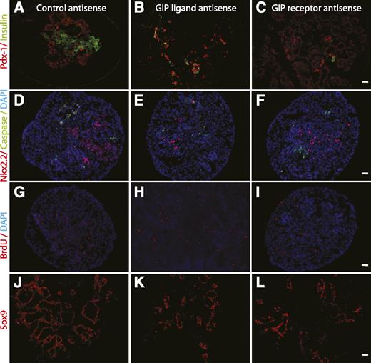 FIG. 6. E11 pancreas cultured for 6 days in the presence of morpholine-ring antisense against GIP, GIPR, or control. Immunohistochemistry was performed for insulin and Pdx-1 (A, B, and C), Nkx2.2 and caspase (D, E, and F), BrdU (G, H, and I), and sox9 (J, K, and L). Both ligand and receptor antisense treatment significantly affected endocrine differentiation, as shown by decreased insulin and Nkx2.2 staining (B, C, E, and F). We also saw a decrease in an undifferentiated progenitor cell population suggested by decreased Pdx-1 and sox9 staining. However, the antisense treatment did not induce apoptosis (D, E, and F) or change the proliferation rate (G, H, and I) (magnification size bars: 20 μmol/L). (A high-quality digital representation of this figure is available in the online issue.)