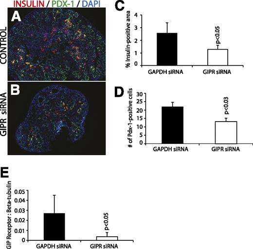 FIG. 7. GIPR siRNA. Immunohistochemistry of GIPR siRNA-treated cultured pancreas for insulin and Pdx-1 (A and B) is shown. In GIPR siRNA-treated cultured pancreas, there was a significant decrease in the number of insulin-positive staining (C). Pdx-1–positive cells were counted, and there was a significant decrease in GIPR siRNA-treated tissues (D) (magnification size bars: 100 μmol/L). Semiquantitative RT-PCR for GIPR was performed to confirm effective gene knockdown (E). (A high-quality digital representation of this figure is available in the online issue.)