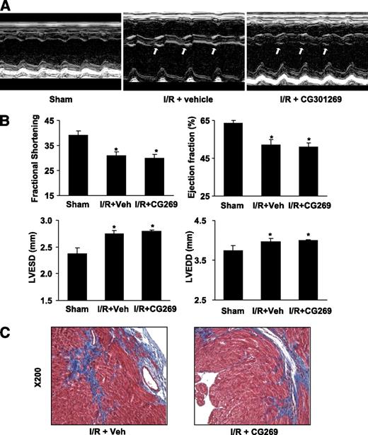 FIG. 8. CG301269 does not aggravate heart failure after myocardial ischemia/reperfusion (I/R) in C57BL/6J mice. Surgical reperfused myocardial infarction was induced in mice as described in research design and methods. Three groups of mice—sham, myocardial I/R with carboxymethyl cellulose (CMC) as vehicle, and myocardial I/R with CG269 dissolved with CMC—were monitored for 4 weeks. A: Echocardiography was performed at baseline and at 4 weeks after myocardial I/R with a 14-MHz linear probe (Toshiba, Japan). White arrow indicates hypokinetic wall motion abnormality in the septum area. B: Heart function was analyzed by measuring fractional shortening (FS = [LV end-diastolic diameter (LVEDD) − LV end-systolic diameter (LVESD)] × 100/LVEDD) and LV ejection fraction (LVEF = [LVEDD2 − LVESD2]/LVEDD2). C: Histologic analysis. Heart tissue was sectioned in to 4 μm slices and stained with Masson trichrome for evaluation of fibrosis. *P < 0.05 vs. sham. LV, left ventricle. (A high-quality digital representation of this figure is available in the online issue.)