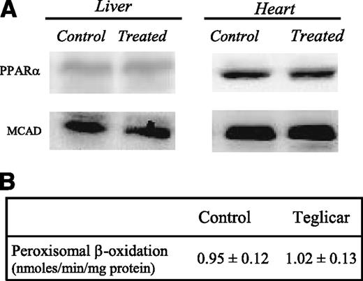 FIG. 6. A: Representative Western blot of the reported target proteins. Protein extracts were obtained from tissue of control or teglicar-treated db/db mice (n = 8) subjected to analysis. B: Liver peroxisomal β-oxidation activity in controls and teglicar-treated mice.