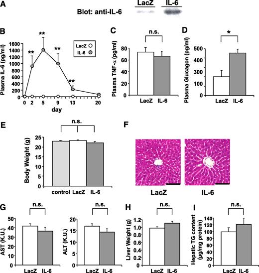 FIG. 1. Adenoviral overexpression of IL-6 raises plasma IL-6 concentrations. Eight-week-old C57Bl/6N male mice were administered adenovirus containing the LacZ or the IL-6 gene. A: Immunoblotting of hepatic lysates with anti-IL-6 antibody on day 5 after adenoviral administration. B: Plasma IL-6 concentrations were measured in LacZ- (open circles; n = 5) and IL-6 (closed circles; n = 7) mice through day 20 after adenoviral administration. C: Plasma TNF-α concentrations were measured in LacZ- (open bar; n = 5) and IL-6 (closed bar; n = 7) mice on day 5 after adenoviral administration. D: Fasting plasma glucagon levels were measured in LacZ- (open bar; n = 4) and IL-6 (closed bar; n = 4) mice on day 5 after adenoviral administration. E: Body weights of control (not administered adenovirus) (shaded bar; n = 5), LacZ- (open bar; n = 5), and IL-6 (closed bar; n = 7) mice on day 7 after adenoviral administration. F: Histological findings of the liver with hematoxylin and eosin staining on day 5 after adenoviral administration. Scale bars indicate 100 μm. G–I: Plasma aspartic aminotransferase (AST) and alanine aminotransferase (ALT) levels (G), liver weights (H), and hepatic triglyceride content (I) were measured in LacZ- (open bars; n = 5) and IL-6 (closed bars; n = 7) mice on day 5 after adenoviral administration. *P < 0.05; **P < 0.01 vs. LacZ-mice assessed by unpaired t test in B–D, G–I, and by one-way ANOVA followed by Bonferroni’s post hoc test in E. Data are presented as means ± SE. (A high-quality digital representation of this figure is available in the online issue.)