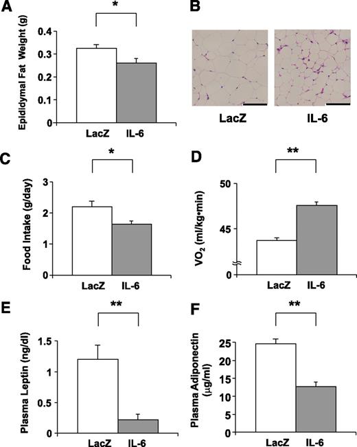 FIG. 2. Adenoviral overexpression of IL-6 reduces adipose tissue. A: Epididymal fat weights in LacZ- (open bar; n = 5) and IL-6 (closed bar; n = 7) mice were measured on day 5 after adenoviral administration. B: Histological findings of the epididymal fat tissue with hematoxylin and eosin staining on day 5 after adenoviral administration. Scale bars indicate 100 μm. C: Mean daily food intakes for 5 days were calculated in LacZ- (open bar; n= 5) and IL-6 (closed bar; n= 7) mice. D–F: Resting oxygen consumption (n = 3 per group) (D) and plasma levels of leptin (E) and adiponectin (F) were measured in LacZ- (open bars; n = 5) and IL-6 (closed bars; n = 7) mice. *P < 0.05; **P < 0.01 vs. LacZ-mice assessed by unpaired t test. Data are presented as means ± SE. (A high-quality digital representation of this figure is available in the online issue.)