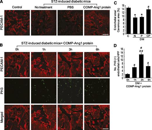 FIG. 2. COMP-Ang1 protein transfer increases cavernous endothelial content through enhanced endothelial cell proliferation. A: Anti–PECAM-1 staining of cavernous tissue from age-matched control mice (C), untreated STZ-induced diabetic mice (N), or STZ-induced diabetic mice 2 weeks after receiving repeated intracavernous injections of PBS (P; days −3 and 0; 20 μL) or COMP-Ang1 protein (CP; days −3 and 0; 5.8 μg/20 μL). Scale bar = 100 μm. B: Immunohistochemical staining of cavernous tissue using antibodies to PECAM-1 (red) and phosphohistone H3 (PH3; green) in untreated STZ-induced diabetic mice (0 h) or STZ-induced diabetic mice 1, 3, and 6 h after intracavernous injection of the COMP-Ang1 protein (5.8 μg/20 μL). Scale bar = 50 μm. C: Quantitative analysis of endothelial cell content in the cavernous tissue was performed by using an image analyzer. Each bar depicts the means ± SE from n = 6 animals per group. *P < 0.01 vs. the C and CP groups; #P < 0.01 vs. the N and P groups. D: Number of PH3-immunopositive endothelial cells per high-power field (screen magnification ×400). Each bar depicts the means ± SE from n = 6 animals per group. #P < 0.01 vs. the 0-h group; ##P < 0.01 vs. the 1- and 6-h groups. DM, diabetes. (A high-quality color representation of this figure is available in the online issue.)