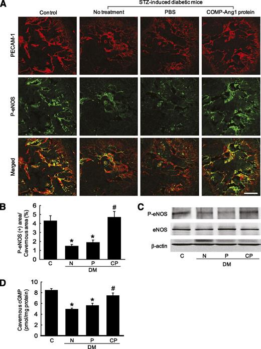 FIG. 3. COMP-Ang1 protein transfer induces cavernous eNOS phosphorylation and increases cGMP concentration. A: Immunofluorescent double staining of cavernous tissue performed with antibodies to PECAM-1 (red) and phospho-eNOS (Ser1177; green) in age-matched control mice (C), untreated STZ-induced diabetic mice (N), or STZ-induced diabetic mice 2 weeks after receiving intracavernous injections of PBS (P; days −3 and 0; 20 μL) or COMP-Ang1 protein (CP; days −3 and 0; 5.8 μg/20 μL). Scale bar = 100 μm. B: Quantitative analysis of phospho-eNOS–positive area in the cavernous tissue was performed by using an image analyzer. Each bar depicts the means ± SE from n = 6 animals per group. *P < 0.01 vs. the C and CP groups; #P < 0.01 vs. the N and P groups. C: Western blot analysis demonstrating the relative abundance of phospho-eNOS (Ser1177) in each group. Corpus cavernosum tissues were harvested after electrical stimulation of the cavernous nerve for 1 min. Results were similar for four independent experiments. D: Cavernous cGMP concentrations. Each bar depicts the means ± SE from n = 4 animals per group. *P < 0.01 vs. the C and CP groups; #P < 0.01 vs. the N and P groups. DM, diabetes; P-eNOS, phosphorylated eNOS. (A high-quality color representation of this figure is available in the online issue.)