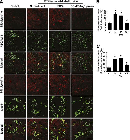 FIG. 5. COMP-Ang1 protein transfer decreases cavernous nitrotyrosine production. A: Immunofluorescent double staining of cavernous tissue performed with the antibody to nitrotyrosine, a marker of peroxynitrite formation, and the antibody to PECAM-1 or with antibodies to nitrotyrosine and smooth-muscle α-actin in age-matched control mice (C), untreated STZ-induced diabetic mice (N), or STZ-induced diabetic mice 2 weeks after receiving intracavernous injections of PBS (P; days −3 and 0; 20 μL) or COMP-Ang1 protein (CP; days −3 and 0; 5.8 μg/20 μL). Scale bar = 100 μm. B and C: An image analyzer was used to quantitate nitrotyrosine-immunopositive endothelial or smooth-muscle area. Each bar depicts the means ± SE from n = 6 animals per group. *P < 0.05 vs. the C and CP groups; #P < 0.05 vs. the N and P groups. DM, diabetes. (A high-quality color representation of this figure is available in the online issue.)