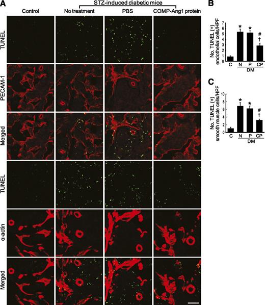 FIG. 6. COMP-Ang1 protein transfer decreases apoptosis in cavernous endothelial cells and smooth-muscle cells. A: Double labeling of cavernous tissue with TUNEL and the antibody to PECAM-1 or with TUNEL and the antibody to smooth-muscle α-actin in age-matched control mice (C), untreated STZ-induced diabetic mice (N), or STZ-induced diabetic mice 2 weeks after receiving intracavernous injections of PBS (P; days −3 and 0; 20 μL) or COMP-Ang1 protein (CP; days −3 and 0; 5.8 μg/20 μL). Scale bar = 50 μm. B and C: Number of apoptotic cells in endothelial cells or smooth-muscle cells per high-power field (screen magnification ×400). Each bar depicts the means ± SE from n = 6 animals per group. *P < 0.01 vs. the C and CP groups; #P < 0.01 vs. the N and P groups; †P < 0.05 vs. the C group. DM, diabetes. (A high-quality color representation of this figure is available in the online issue.)