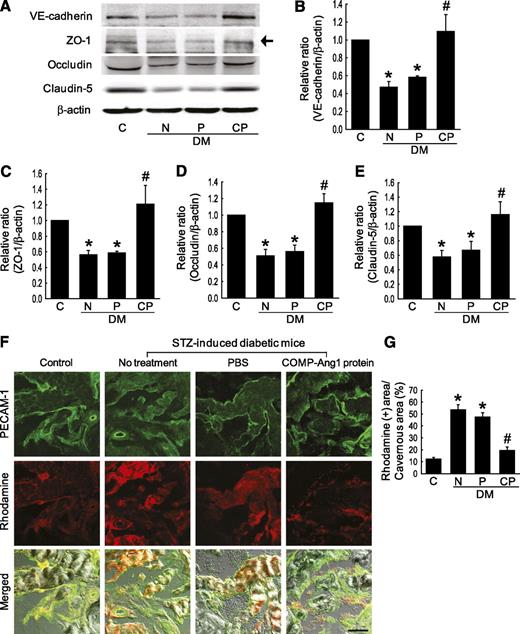 FIG. 7. COMP-Ang1 protein transfer restores endothelial cell-cell junction proteins and decreases cavernous endothelial permeability. A: Representative Western blot for VE-cadherin, ZO-1, occludin, and claudin-5 in age-matched control mice (C), untreated STZ-induced diabetic mice (N), or STZ-induced diabetic mice 2 weeks after receiving intracavernous injections of PBS (P; days −3 and 0; 20 μL) or COMP-Ang1 protein (CP; days −3 and 0; 5.8 μg/20 μL). B–E: Data are presented as the relative density of each protein compared with that of β-actin. The relative ratio of the control group was arbitrarily set equivalent to 1. Data are representative of four independent experiments. *P < 0.05 vs. the C and CP groups; #P < 0.05 vs. the N and P groups. F: Diffusion of fluorescent tracer in the corpus cavernosum tissue. The fluorescent tracer rhodamine-dextran (red, 40 kDa; 25 mg/mL in saline) was injected into the jugular vein of each group of mice. After 10 min, corpus cavernosum tissues were harvested after electrical stimulation of the cavernous nerve for 1 min to enhance blood flow into the penis and were then stained with the antibody to PECAM-1 (green). Scale bar = 50 μm. G: The intensity of fluorescence in the nonvascular area of the corpus cavernosum tissue was measured by image analysis. Each bar depicts the means ± SE from n = 4 animals per group. *P < 0.01 vs. the C and CP groups; #P < 0.01 vs. the N and P groups. DM, diabetes. (A high-quality color representation of this figure is available in the online issue.)