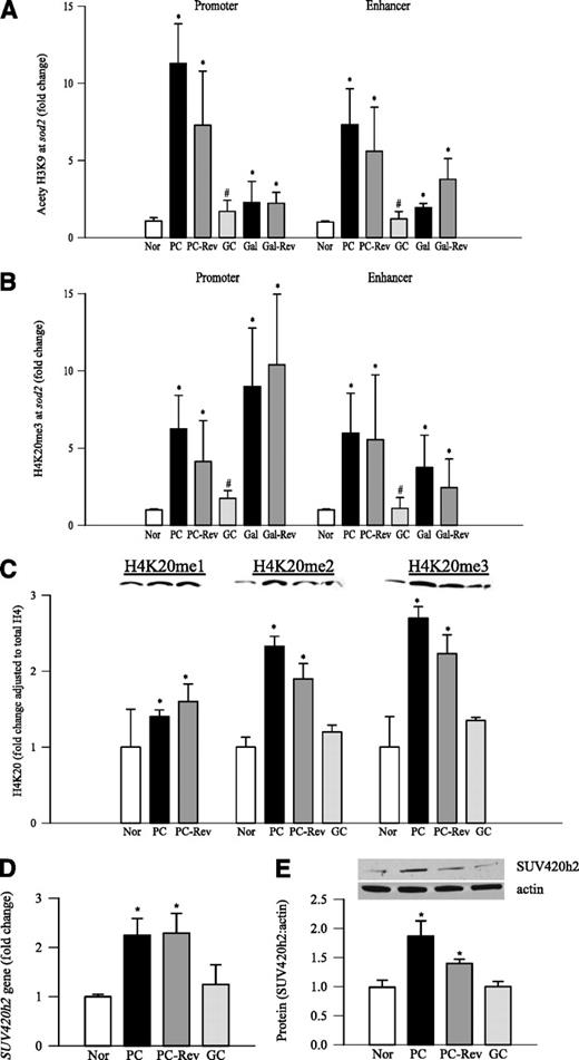 FIG. 2. Retinal H4K20me3 and acetyl H3K9 at sod2, methylation of H4K20, and the expression of SUV420h2: the levels of acetyl H3K9 (A) and H4K20me3 (B) at the sod2 promoter and enhancer were determined using the ChIP technique. Retinal chromatins were immunoprecipitated with H4K20me3 or acetyl H3K9 antibody, and the sod2 promoter and enhancer region were amplified. The q-PCR value in each immunoprecipitate was normalized to the Ct value from the input sample using the ΔΔCt method. C: The protein expression of methylated H4K20 was detected by Western blot technique using antibodies specific for mono-, di-, and trimethyl H4K20 using histone H4 as the loading control. D: Gene expression of SUV420h2 was detected by q-PCR and analyzed by the ΔΔCt method. The housekeeping gene was β-actin. Fold-changes were calculated by setting the mean fraction of normal rats as 1. E: Protein expression of SUV420h2 was quantified by Western blot, and β-actin was used as a loading protein. Values are represented as mean ± SD of five to six rats in each group. *P < 0.05 compared with normal, and #P < 0.05 compared with PC. Nor, normal.