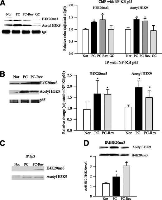 FIG. 4. The interactions of H4K20me3 and acetyl H3K9 with NF-κB p65 in the retina. A: The crosslinked retina was immunoprecipitated with NF-κB p65 antibody, and the pull-down proteins in the immunoprecipitated chromatin were separated by Western blots using acetyl H3K9 and H4K20me3 antibodies. IgG was used as a loading control. The histogram (upper right) represents the intensity of each band adjusted to IgG in the same sample. B: The interaction of NF-κB p65 with acetyl H3K9 or H4K20me3 was detected by immunoprecipitation. Rat retinal homogenate was immunoprecipitated with NF-κB p65 antibody. Acetyl H3K9 or H4K20me3 in the precipitate was detected by Western blot. For loading efficiency, the membranes were reprobed with NF-κB p65. The histograms represent the ratio of NF-κB p65/acetyl H3K9 or NF-κB p65/H4K20me3 adjusted to p65 in each lane. C: Expressions of H4K20me3 or acetyl H3K9 in retinal protein precipitated with rabbit IgG (negative control for IP). D: For H4K20me3 and acetyl H3K9 interactions, rat retinal homogenate was immunoprecipitated with H4K20me3 antibody, and the immunoprecipitate was detected for acetyl H3K9 by Western blot. The values represent mean ± SD obtained from four to five rats in each group. *P < 0.05 compared with normal. Ac, acetyl; IP, immunoprecipitation; Nor, normal.