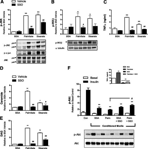 FIG. 1. The putative CD36 inhibitor SSO prevents saturated fatty acid–induced lipid accumulation and macrophage inflammation, resulting in improved insulin signaling in adipocytes. RAW264.7 macrophages were incubated with vehicle or the putative CD36 inhibitor SSO for 4 h then with either BSA (vehicle) or the saturated fatty acids palmitate (16:0) or stearate (18:0) for an additional 4 h. Cellular extracts were analyzed for phosphorylated (p) (Thr183/Tyr185) JNK (A), its substrate phosphorylated (Ser73) c-jun total JNK (B), and phosphorylated (Ser181) IKKβ (C) by Western blotting. TNFα released into the media was measured by ELISA. Total ceramide (D) and DAG (E) were extracted and quantified via thin-layer chromatography. F: To obtain conditioned media, RAW264.7 macrophages were incubated with vehicle or SSO overnight then with BSA (vehicle) or palmitate (Palm) for 2 h and then palmitate/BSA-free media for 4 h. This conditioned media, or nonconditioned control media (Con), was incubated with differentiated 3T3-L1 adipocytes for 48 h before insulin stimulation. Cellular extracts were analyzed for phosphorylated (p) (Ser473) Akt and total Akt. TNFα released into the conditioned media was measured via ELISA (inset). Data shown are from one experiment, representative of two to four independent experiments, expressed as means ± SE (n = 3). A–E and F, inset: *P < 0.05 fatty acid vs. BSA; **P < 0.001 fatty acid vs. BSA; #P < 0.05 SSO vs. vehicle; ##P < 0.001 SSO vs. vehicle. F: **P < 0.001 insulin stimulated vs. control insulin stimulated; #P < 0.05 palmitate conditioned media insulin stimulated vs. palmitate plus SSO conditioned media insulin stimulated; two-way ANOVA with post hoc analysis.