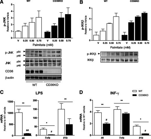FIG. 5. CD36KO BMDMs show a blunted proinflammatory response to LPS and INF-γ but not palmitate. Bone marrow–derived macrophages from wild-type (WT) and CD36KO mice were treated with increasing concentrations of the saturated fatty acid palmitate (16:0) or BSA (vehicle) for 4 h. Cellular extracts were analyzed for phosphorylated (p) (Thr183/Tyr185) and total JNK, CD36, β-actin (A) and phosphorylated (p) (Ser181) and total IKK (B) by Western blotting. Bone marrow–derived macrophages from WT and CD36KO mice were treated with LPS (C) or INF-γ (D) for 6 h and gene expression of TNFα, IL-6, and IL-1β were assessed by real-time PCR. All data are expressed as means ± SE. A and B: n = 3–9, data are the combination of three independent experiments. C and D: n = 6, data are from one experiment. *P < 0.05 treatment vs. vehicle; **P < 0.001 treatment vs. vehicle; #P < 0.05 WT vs. CD36KO; ##P < 0.001 WT vs. CD36KO; two-way ANOVA with post hoc analysis.