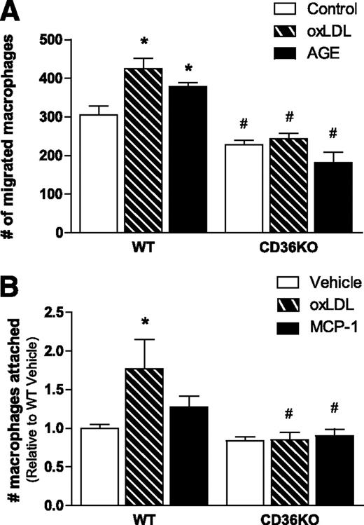 FIG. 6. CD36KO peritoneal macrophages do not migrate in response to adipocyte-derived chemotactic factors. A: Wild-type (WT) and CD36KO peritoneal macrophages were placed in transwell inserts with an 8 μmol/L porous membrane and incubated with conditioned media from vehicle, oxLDL, or AGE-treated primary adipocytes for 16 h. Macrophages that migrated to the other side of the membrane were stained and counted; each replicate is the average of four fields. B: WT and CD36KO peritoneal macrophages were treated with vehicle, oxLDL, or MCP-1 for 18 h. Macrophages attached to the cell culture plate were stained with PKH dye and fluorescence quantified. All data are expressed as means ± SE. A: n = 4; B: n = 6–15. *P < 0.05 treatment vs. vehicle; #P < 0.05 WT vs. CD36KO; two-way ANOVA with post hoc analysis.