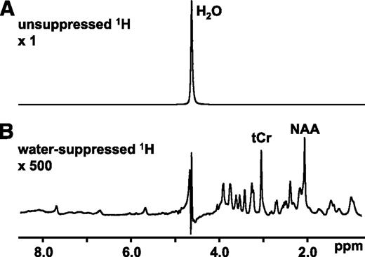 FIG. 2. In vivo MR spectra are dominated by signals from highly abundant metabolites. A: The 1H spectrum of the brain features a prominent water peak that overwhelms the metabolite signals. Pulse sequences are available that selectively suppress or excite specific frequencies. B: The inclusion of a water-suppression module selectively minimizes the 1H2O peak and enhances the detection of brain metabolites. tCr, creatine-CH3.