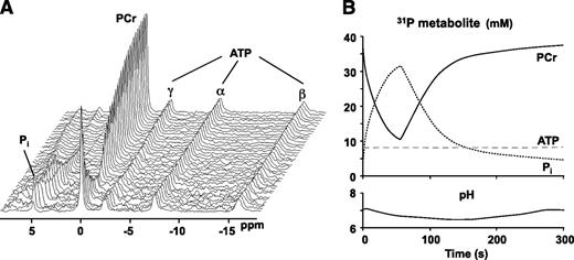 FIG. 4. A: Dynamic 31P-MRS data acquired during muscle contraction and recovery (data courtesy of J. Kent-Braun). B: To maintain cellular ATP concentrations (dashed line) during the contraction, PCr (solid line) is depleted because of the CK reaction and Pi (dotted line) accumulates. Intracellular pH, calculated from the chemical shift separation between the PCr and Pi peaks, increases initially as a result of PCr hydrolysis; H+ production attributed to anaerobic glycolysis may cause intracellular acidification during longer contraction protocols. PCr, Pi, and pH recover to baseline upon cessation of the contraction.