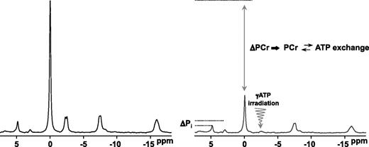 FIG. 5. Unidirectional fluxes attributed to chemical exchange can be measured using MT techniques. Application of 31P saturation-transfer MRS in muscle: frequency-selective irradiation of the γATP peak causes reductions in the magnitude of the PCr and Pi peaks as a result of PCr ⇆ ATP (CK) and Pi ⇆ ATP (ATP synthesis/hydrolysis) exchange, respectively.
