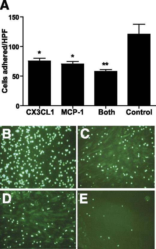 FIG. 4. CX3CL1 modulates adhesion of human monocytes to primary human adipocytes. A: Mean number (± SD) of fluorescent THP-1 monocytes adherent to primary adipocytes were counted per HPF in each experimental condition. The groups designated for each block refer to blocking antibodies used in the condition. *P < 0.0001 compared with negative antibody; **P < 0.005 compared with CX3CL1 alone. Representative images for negative antibody (B), CX3CL1 antibody (C), MCP-1 antibody (D), and both CX3CL1 and MCP-1 antibodies (E) are shown. (A high-quality digital representation of this figure is available in the online issue.)