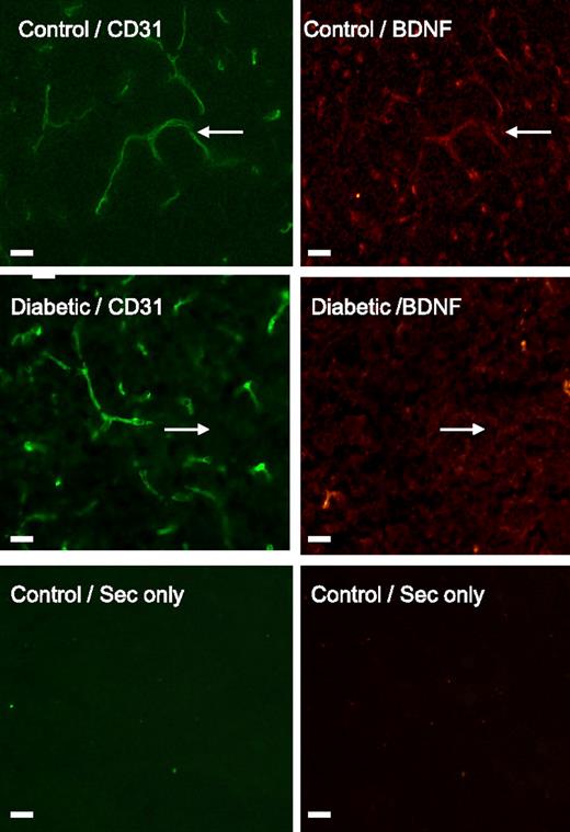 FIG. 2. BDNF expression is reduced in the diabetic brain endothelium. Representative images of cortical sections (2-mm thick) from 6-week diabetic and age-matched nondiabetic rats immunostained for BDNF. Blood vessels (arrows) are visualized by CD31 staining (left). Cortex microvessels from a diabetic rat show decreased BDNF immunofluorescence when compared with those of a nondiabetic rat (right). Magnification 40×. (A high-quality digital representation of this figure is available in the online issue.)