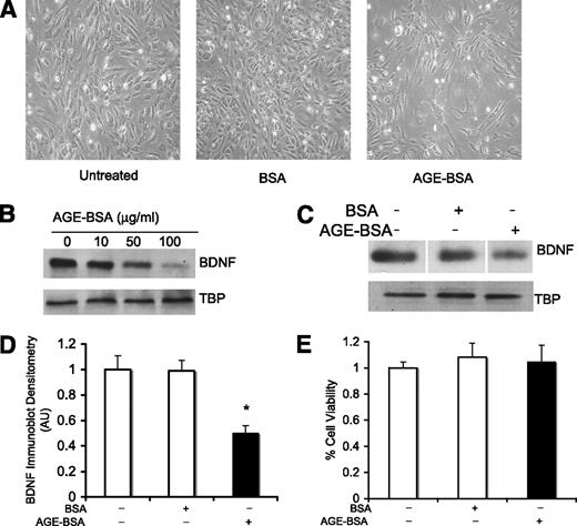 FIG. 3. AGE-BSA treatment decreases BDNF levels in endothelial cells. A: Cell morphology is altered by 48-h AGE-BSA treatment. Cells show decreased cell–cell contact and changes in cell shape. B: Representative Western blot shows that BDNF protein is reduced in cell lysates in a dose-dependent manner after AGE treatment (10–100 μg/mL). TATA-binding protein is used as loading control. C: Representative Western blot shows that exposure to 50 μg/mL of AGE-BSA reduced BDNF protein. Treatment with 50 μg/mL of unglycated BSA did not alter BDNF levels. Gel sections were derived from a single representative Western blot. D: Quantitative densitometry showing that AGE-BSA–treated endothelial cells expressed significantly lower BDNF compared with untreated cells or cells treated with normal BSA. *P < 0.05 between untreated and AGE-BSA treatment, N = 3 per group. E: AGE-BSA treatment (50 μg/mL) did not cause overt cytotoxicity as measured by the MTT assay, N = 3 per group. TBP, TATA-binding protein.