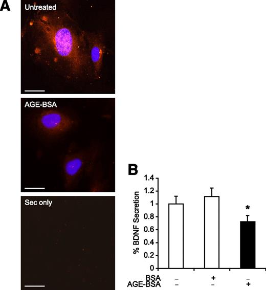 FIG. 4. BDNF expression and secretion are reduced after AGE treatment in brain endothelial cells. A: Representative images from untreated and AGE-treated brain endothelial cells, stained for BDNF by immunocytochemistry. BDNF is localized in perinuclear areas and at the plasma membrane in untreated cells. A reduction in BDNF staining after AGE-BSA treatment is observed compared with untreated cells. B: BDNF secretion is decreased after AGE-BSA treatment, as quantified by enzyme-linked immunosorbent assay on brain endothelial-conditioned media (E-CM) across treatments. *P < 0.05 between untreated and AGE-BSA treatment, N = 5 per group. (A high-quality digital representation of this figure is available in the online issue.)