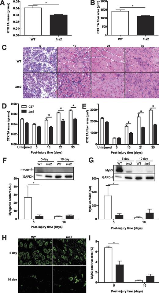FIG. 1. Type 1 diabetes impairs regeneration of skeletal muscle after CTX injury. Ten days after injury, TA muscle of the 1-week diabetic Ins2WT/C96Y mice demonstrates a significant loss of (A) mass (t test: P = 0.015; N = 3) and (B) myofiber cross-sectional area (t test: P = 0.014; N = 3) compared with WT, indicating impaired regeneration after injury at only 7 days of type 1 diabetes. C: Hematoxylin–eosin staining of TA injured at 8 weeks of type 1 diabetes demonstrates loss of (D) muscle mass (N = 16) and (E) myofiber area (N = 16) compared with WT beginning at 10 days postinjury. The uninjured time point in both panels is the contralateral TA to the 5-day post-CTX muscle and is included to illustrate the decrease in muscle mass and myofiber area associated with the impaired growth of skeletal muscle in the type 1 diabetic state. The values for the uninjured time point are not included in the statistical analysis. A main effect of diabetes (main effect: P < 0.001) is observed in both mass and fiber area with the asterisk (*) denoting specific differences between WT and Ins2WT/C96Y as defined by post hoc analysis. Note that the type 1 diabetic muscle does not return to WT mass/fiber size at later time points, but continues to lag in regeneration. Because early expression of myogenic proteins is critical to the early stages of regeneration, (F) myogenin (main effect: P = 0.062, interaction: P = 0.017; N = 8) and (G) embryonic myosin heavy chain (Myh3) expression (main effect: P = 0.117, interaction: P = 0.009; N = 8) were determined in quadriceps muscle and demonstrate significantly increased expression at 5 days postinjury in WT but not Ins2WT/C96Y (labeled Ins2, F and G). H: Immunofluorescent staining of injured TA with anti-Myh3 confirms (I) the lack of Myh3 positive fibers in Ins2WT/C96Y compared with WT (main effect: P = 0.013; interaction: P < 0.001; N = 8) at 5 days postinjury. *Differences between groups at specific time points identified by Bonferroni post hoc analysis after 2-way ANOVA (D–G, I). A–I: White bars represent WT, and black bars represent Ins2WT/C96Y. (A high-quality digital representation of this figure is available in the online issue.)