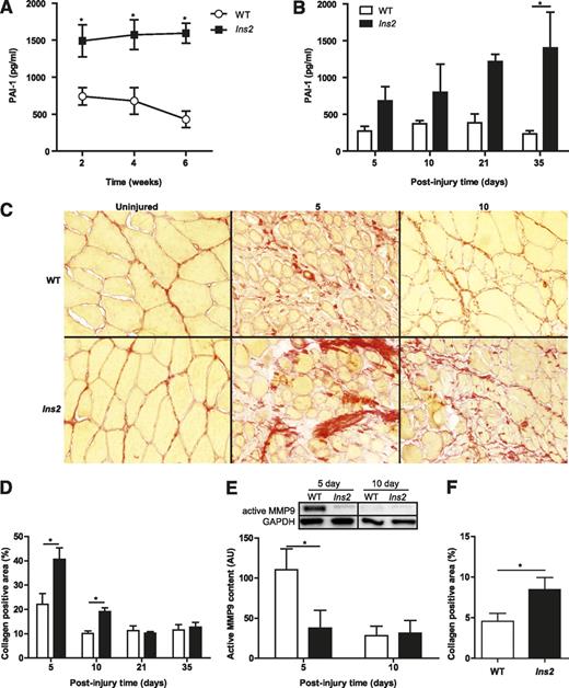 FIG. 2. Type 1 diabetes causes elevated PAI-1, suppresses MMP9 activation, and increases collagen content during early regeneration time points. Significantly elevated PAI-1 levels in Ins2WT/C96Y mice compared with WT mice were found in blood plasma collected (A) throughout type 1 diabetes progression (main effect: P < 0.001; N = 16) and (B) after CTX injury (main effect: P < 0.001; N = 16). This led to the hypothesis that collagen would be elevated in the Ins2WT/C96Y mice because of suppression of the fibrinolytic pathway. C: Picrosirius red staining of injured TA sections revealed increased collagen (red color), which was statistically significant (D, main effect: P = 0.001, interaction: P = 0.004; N = 16). E: MMP9, an important protease in skeletal muscle collagen cleavage, was also found to be significantly repressed in Ins2WT/C96Y mice (labeled Ins2, E) at the 5-day time point (N = 8). F: The short-term Ins2WT/C96Y mice also exhibited increased collagen at 10 days postinjury (t test: P = 0.047, N = 3). *Differences between groups at specific time points identified by Bonferroni post hoc analysis after 2-way ANOVA (A, B, D, E). A–E: White bars/circles represent WT, and black bars/squares represent Ins2WT/C96Y. (A high-quality digital representation of this figure is available in the online issue.)