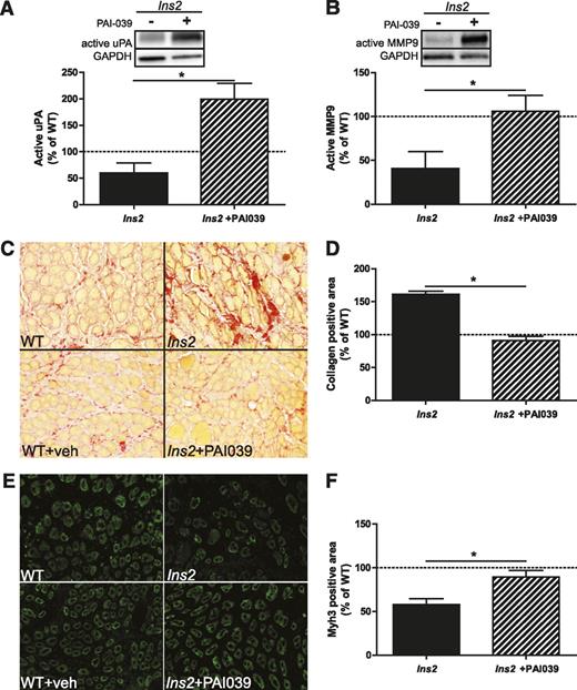 FIG. 3. Pharmacologic treatment against PAI-1 improves fibrinolytic pathway activity, collagen degradation, and regeneration at 5 days post-CTX injury in type 1 diabetes. A: Treatment with PAI-039 caused an increase in free uPA in Ins2WT/C96Y compared with untreated Ins2WT/C96Y (t test: P = 0.004; N = 4). B: Similarly, active MMP9 was elevated in PAI-039–treated Ins2WT/C96Y (t test: P = 0.025; N = 4). These findings are characteristic of restored fibrinolytic pathway activity, which presumably led to the (C and D) reduced collagen levels (t test: P < 0.001; N = 4) and (E and F) increased Myh3-positive area (t test: P = 0.011; N = 4) observed in PAI-039–treated Ins2WT/C96Y compared with untreated Ins2WT/C96Y (labeled Ins2, C and E). A–E: Black bars represent Ins2WT/C96Y, and striped bars represent PAI-039–treated Ins2WT/C96Y. Data are presented relative to the mean of the WT and WT + vehicle pooled data. *Differences between groups identified by t test. (A high-quality digital representation of this figure is available in the online issue.)