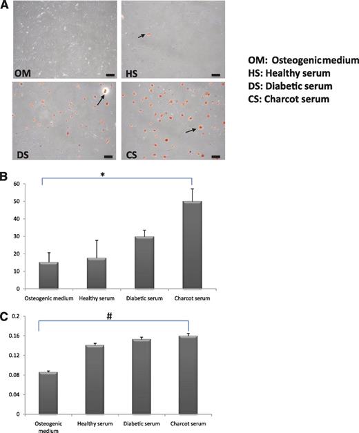 FIG. 4. A: Representative phase-contrast photomicrographs of human VSMCs cultured for 7 days in OM, OM plus healthy serum, OM plus diabetic serum, and OM plus Charcot serum. Mineralization was assessed by the Alizarin red method, which stains mineralized nodules orange-red. Black scale bar = 100 μm. After day 7, the number and density of mineralized cells (black arrows) were greater in Charcot serum compared with diabetic and healthy serum or OM control subjects. B: ALP (μmol/L phosphate/mg protein/min) was used as a marker of early osteoblastic differentiation. Total protein was determined by bicinchoninic acid assay, and the para-nitrophenyl phosphate method was used to quantitate ALP activity. ALP activity was markedly elevated in human VSMCs cultured with Charcot serum compared with diabetic serum, healthy serum, or osteogenic control medium. *ANOVA test for overall differences, P < 0.0001. C: Alizarin dye was eluted from human VSMCs, and the amount of dye uptake was used to quantify mineralization by measuring optical densities at 414 nm. Human VSMCs cultured in Charcot serum displayed an accentuated mineralization response compared with diabetic serum, healthy serum, or osteogenic control medium. #ANOVA test for overall differences P < 0.0001. CS, Charcot serum; DS, diabetic serum; HS, healthy serum. (A high-quality digital representation of this figure is available in the online issue.)