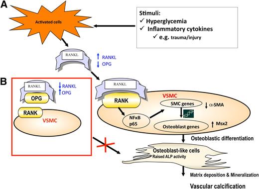 FIG. 7. External stimuli (hyperglycemia, inflammation resulting from trauma, infection, or other injury) activate certain cells (e.g., endothelial cells, osteoblasts) to release RANKL. When the RANKL/OPG ratio is high as in CN (A), RANKL binds to its receptors (RANK) on VSMCs to activate NF-κB and cause downstream cell signaling cascades, resulting in osteoblastic differentiation and deposition of mineralized matrix leading to MAC. However, when the OPG levels are low or the RANKL/OPG ratio is not elevated (B), OPG acts as a decoy receptor mopping excess RANKL and preventing human VSMCs from undergoing osteoblastic differentiation and mineralization. SMC, smooth muscle cell.