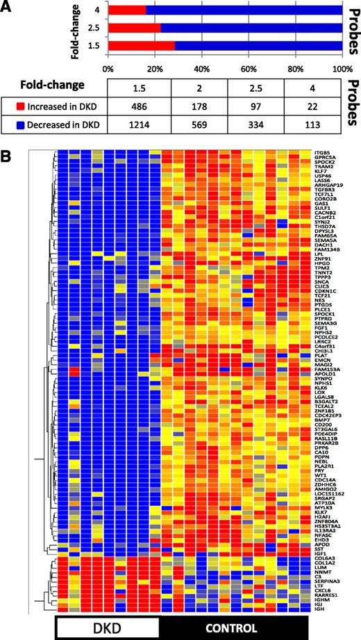 FIG. 2. Differentially expressed transcripts in DKD glomeruli. A: Statistical significance was determined using a fold-change cutoff of 1.5 and a Benjamini-Hochberg multiple-testing correction P value < 0.05. The graph represents the number of increased (red) or decreased (blue) probesets in the glomerular compartment with the indicated fold change (1.5- to 4.0-fold). B: Hierarchal cluster (Manhattan distance and complete linkage) of the 100 genes with highest fold change differentially expressed in control and DKD glomeruli.