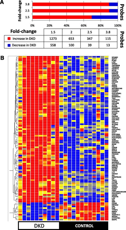 FIG. 3. Differentially expressed transcripts in DKD tubulointerstitium compared with control samples. A: Statistical significance was determined using a fold-change cutoff of 1.5 and a Benjamini-Hochberg multiple-testing correction P value < 0.05. The graph represents the number of increased (red) or decreased (blue) probesets in the glomerular compartment with the indicated fold change (1.5- to 3.8-fold). B: Hierarchal cluster (Manhattan distance and complete linkage) of the 100 transcripts with highest fold change differentially expressed in control and DKD tubulointerstitium.