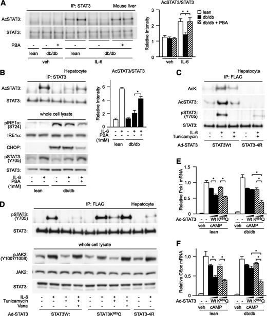 FIG. 5. Acetylated mutant of STAT3 is less susceptible to ER stress–induced suppression of STAT3 activation. A: Control mice (lean), db/db mice (db), and PBA-treated db/db mice were subjected to continuous IL-6 administration in the presence of somatostatin, and the level of acetylation of hepatic STAT3 was determined by Western blotting (left). Quantitation of STAT3 acetylation levels is normalized to immunoprecipitated STAT3 and is represented as mean ± SE (right). *P < 0.05 (n = 6 in each group); open bar, lean mice; closed bar, db/db mice; striped bar, PBA-treated db/db mice. B: db/db mouse–derived isolated hepatocytes were pretreated with PBA and analyzed for the level of IL-6–stimulated acetylation of STAT3 (left). Quantitation of STAT3 acetylation levels is normalized to immunoprecipitated STAT3 and is represented as mean ± SE (right). Open bar, lean hepatocyte; closed bar, db/db hepatocytes. C: Lean mouse–derived isolated hepatocytes were forced to express wild-type STAT3 or 4R mutant via adenovirus vector, treated with tunicamycin, and analyzed for the level of IL-6–dependent acetylation and tyrosine phosphorylation of exogenously induced STAT3. Cell extracts were immunoprecipitated with anti-FLAG antibody and analyzed by anti–acetyl-lysine (AcK), acetyl-STAT3, phospho-STAT3, and total STAT3 antibody. D: Lean mouse–derived hepatocytes were forced to express wild-type STAT3 or K685Q mutant via infection with an adenovirus vector, treated with tunicamycin and orthovanadate (Vana) for 6 h, and analyzed for the level of IL-6–dependent tyrosine phosphorylation of exogenously induced STAT3. The top row shows the levels of STAT3 tyrosine phosphorylation from an immunoprecipitate with anti-FLAG antibody. The bottom row shows the levels of JAK2 phosphorylation from whole cell lysate. E and F: Lean mouse–derived hepatocytes or db/db mouse–derived isolated hepatocytes were forced to express wild-type STAT3 or K685Q mutant via infection with an adenovirus vector at multiplicity of infection values 3 and 10 and analyzed for their suppressive effect on expressions of Pck1 (E) and G6pc (F) by quantitative RT-PCR. Data are represented as mean ± SE. *P < 0.05 (n = 4 in each group); open bar, β-galactosidase overexpression (control); closed bar, wild-type STAT3; striped bar, K685Q-infected mutant.