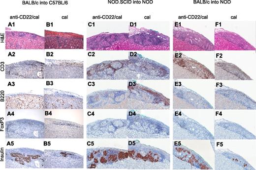 FIG. 3. Islet pathology in the three immune settings of islet transplantation (allo, auto, and allo/auto). Islets from BALB/c or NOD.SCID mice were transplanted under the kidney capsule of chemically induced hyperglycemic C57BL/6 or spontaneously hyperglycemic NOD mice treated with anti-CD22/cal or cal and were retrieved for histological analysis at different time points (n = 3 mice/group). Grafts from both BALB/c into C57BL/6– and NOD.SCID into NOD–transplanted mice were collected 14 days after transplantation, whereas BALB/c into NOD grafts were collected at day 7 at the time of graft rejection of control mice. 1) In allo at day 14, anti-CD22/cal–treated mice displayed preserved islet architecture (A1) with mild CD3+ cell infiltrate (A2), no B220+ cells (A3), and few FoxP3+ cells (A4). Insulin staining was clearly preserved (A5). Cal-treated and untreated mice showed severe cellular infiltration with a complete disruption of islet architecture (B1) and several CD3+ (B2) and B220+ cells (B3); some CD3+ cells also coexpressed FoxP3+ (B4). Very few cells were positive for insulin (B5). 2) In auto at day 14, anti-CD22/cal–treated mice displayed clear preservation of islet structure (C1) with several CD3+ cells in the infiltrate (C2) surrounding the islets, along with few B220+ (C3) and FoxP3+ cells (C4) as well as abundant insulin-positive cells (C5). Cal-treated mice maintained preservation of islet structure (D1) with insulin-positive cells (D5) but with a massive CD3+ (D2) and B220+ (D3) cell infiltrate and with some FoxP3+ (D4) cells evident in the islet mass. 3) In allo/auto at day 7, islet architecture appeared preserved in anti-CD22/cal–treated mice (E1) with clear insulin staining (E5) but with severe CD3+ cell (E2) infiltrate and few FoxP3+ cells (E4) surrounding the islets, whereas B cells were absent (E3). Conversely, cal-treated mice displayed equally distributed CD3+ (F2) and B220+ (F3) cell infiltration, resulting in complete disruption of islet architecture (F1) and scant insulin staining (F5). Almost no infiltrating FoxP3+ cells were evident (F4). H&E, hematoxylin-eosin. (A high-quality digital representation of this figure is available in the online issue.)