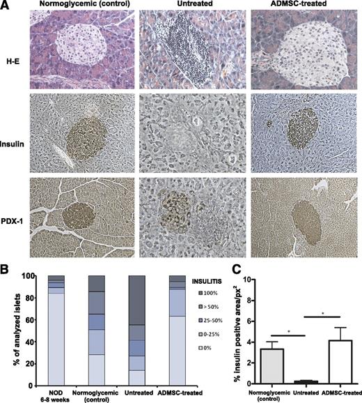 FIG. 3. ADMSC therapy reduces inflammatory cellular infiltrate and improves insulin and PDX-1 expression in pancreatic islets. A: Histological analysis of the pancreas by H-E and immunohistochemistry for insulin and PDX-1 expression, respectively. Original magnification ×400. B: Quantification of mononuclear cellular infiltrate (or insulitis score) in the pancreatic islets was determined by counting approximately 60 islets/experimental group from at least five mice/group using the following classification: 0 (no cellular infiltration), 0–25, 25–50, >50, and 100% of cell infiltration in each islet. C: The positive area for insulin in the pancreatic islets was quantified using the imaging software NIS-Elements AR 3.2 (Nikon). Data are average of % insulin positive area/squared pixels (px2) ± SEM. *P < 0.05. (A high-quality color representation of this figure is available in the online issue.)