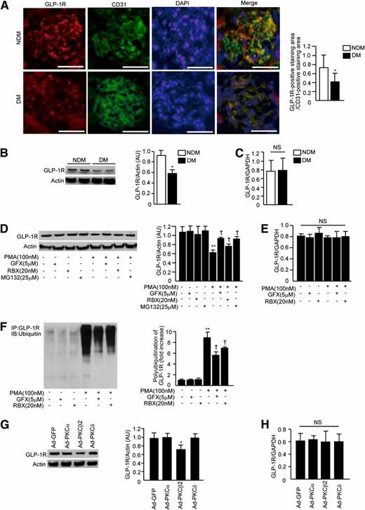 FIG. 1. Diabetes and PKCβ2 activation decreases GLP-1R. A: Immunostaining for GLP-1R and CD31 and merge images in the glomeruli and morphometric analysis of glomerular expression of GLP-1R and CD31. For quantification of the expression of GLP-1R and CD31, the positive staining area/glomerular area (%) was measured using ImageJ (NIH). For each animal, 50 glomeruli were evaluated. Bar = 50 μm. n = 6 in nondiabetic WT and diabetic WT mice; n = 7 in nondiabetic transgenic and diabetic transgenic mice. n = number of mice. DM, mice with STZ-induced diabetes; NDM, nondiabetic mice. *P < 0.05. Magnification ×400. B: Immunoblots of GLP-1R from renal cortex of mice with STZ-induced diabetes for 6 months. n = 6 in nondiabetic WT and diabetic WT mice; n = 7 in nondiabetic transgenic and diabetic transgenic mice. *P < 0.05. C: GLP-1R mRNA expression in the renal cortex of mice with STZ-induced diabetes for 6 months. n = 6 in nondiabetic WT and diabetic WT mice; n = 7 in nondiabetic transgenic and diabetic transgenic mice. D: Immunoblots of GLP-1R in RGECs. RGECs were incubated with PMA (4 h) with or without a PKC-specific inhibitor (GFX), PKCβ-specific inhibitor (RBX), or proteasome inhibitor (MG132). **P < 0.001 vs. PMA−, GFX−, RBX−, and MG132−. †P < 0.05 vs. PMA+, GFX−, RBX−, and MG132−. E: GLP-1R mRNA expression in the renal cortex of mice with STZ-induced diabetes for 6 months. F: Immunoprecipitation and immunoblots of ubiquitin-targeted GLP-1R. RGECs were incubated with PMA (4 h) with or without GFX or RBX. Whole-cell lysates were immunoprecipitated with anti–GLP-1R antibody, subjected to SDS-PAGE, and blotted with ubiquitin antibody. **P < 0.001 vs. PMA−, GFX−, and RBX−. †P < 0.05 vs. PMA+, GFX−, and RBX−. G and H: Immunoblot analyses (G) and mRNA expression (H) of GLP-1R. RGECs were transfected with Ad–green fluorescent protein (GFP), Ad-PKCα, Ad-PKCβ2, or Ad-PKCδ as indicated. *P < 0.05 vs. Ad–green fluorescent protein. One of three independently performed experiments is shown. Comparisons were made between groups using either two-sample and paired t tests for two-way comparisons or one-way ANOVA for multiple groups to establish statistically significant differences. Results are means ± SD. AU, arbitrary units; GAPDH, glyceraldehyde-3-phosphate dehydrogenase; IB, immunoblot; IP, immunoprecipitation; NS, not significant. (A high-quality digital representation of this figure is available in the online issue.)