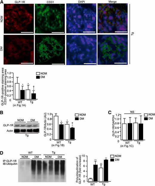 FIG. 2. Decreases of GLP-1R in the glomeruli of EC-PKCβ2Tg mice. A: Immunostaining for GLP-1R and CD31, merge images in the glomeruli, and morphometric analysis of glomerular expression of GLP-1R and CD31. Bar = 50 μm. DM, mice with STZ-induced diabetes; NDM, nondiabetic mice; Tg, EC-PKCβ2Tg mice. n = 6 in nondiabetic WT and diabetic WT mice; n = 7 in nondiabetic transgenic and diabetic transgenic mice. *P < 0.05 vs. nondiabetic WT mice. †P < 0.05 vs. diabetic WT mice. Magnification ×400. B: Immunoblots of GLP-1R from renal cortex of mice with STZ-induced diabetes for 6 months. n = 6 in nondiabetic WT and diabetic WT mice; n = 7 in nondiabetic transgenic and diabetic transgenic mice. *P < 0.05 vs. nondiabetic WT mice. †P < 0.05 vs. diabetic WT mice. C: GLP-1R mRNA expression in the renal cortex of mice with STZ-induced diabetes for 6 months. n = 6 in nondiabetic WT and diabetic WT mice; n = 7 in nondiabetic transgenic and diabetic transgenic mice. D: Immunoprecipitation and immunoblots of ubiquitin-targeted GLP-1R in each group of mice. n = 6 in nondiabetic WT and diabetic WT mice; n = 7 in nondiabetic transgenic and diabetic transgenic mice. **P < 0.001 vs. nondiabetic WT mice. Results are expressed as means ± SD. One of three independently performed experiments is shown. Comparisons were made between groups using either two-sample and paired t tests for two-way comparisons or one-way ANOVA for multiple groups to establish statistically significant differences. AU, arbitrary units; NS, not significant; IP, immunoprecipitation; IB, immunoblot. (A high-quality digital representation of this figure is available in the online issue.)