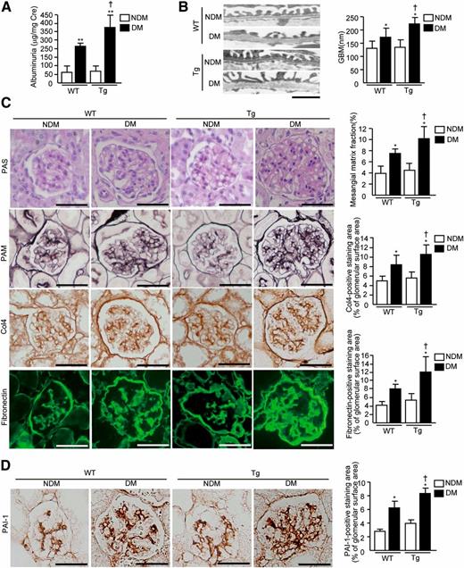 FIG. 3. Functional and histological examinations of diabetic EC-PKCβ2Tg and WT mice. A: Albuminuria in mice with STZ-induced diabetes (DM), nondiabetic mice (NDM), WT mice, and EC-PKCβ2Tg mice is shown. n = 6 in nondiabetic WT and diabetic WT mice; n = 7 in nondiabetic transgenic (Tg) and diabetic transgenic mice. **P < 0.001 vs. nondiabetic WT mice. †P < 0.05 vs. diabetic WT mice. B: Representative views of GBM in each group of mice and quantification of GBM thickness in each group of mice. Bar = 1 μm. n = 6 in nondiabetic WT and diabetic WT mice; n = 7 in nondiabetic transgenic and diabetic transgenic mice. *P < 0.05 vs. nondiabetic WT mice. †P < 0.05 vs. diabetic WT mice. C: Representative light microscopic appearance of glomeruli (periodic acid–Schiff [PAS] and periodic acid–methenamine-silver [PAM] staining), immunohistochemistry of Col4 and fibronectin, and morphometric analysis of periodic acid–methenamine-silver–, Col4-, and fibronectin-positive staining area. The glomerular periodic acid–methenamine-silver–, Col4-, and fibronectin-positive staining area was measured. Bar = 50 μm. n = 6 in nondiabetic WT and diabetic WT mice; n = 7 in nondiabetic transgenic and diabetic transgenic mice. *P < 0.05 vs. nondiabetic WT mice. †P < 0.05 vs. diabetic WT mice. Magnification ×400. D: Immunostaining for PAI-1 in each group of mice and analysis of glomerular expression of PAI-1. Bar = 50 μm. n = 6 in nondiabetic WT and diabetic WT mice; n = 7 in nondiabetic transgenic and diabetic transgenic mice. *P < 0.05 vs. nondiabetic WT mice. †P < 0.05 vs. diabetic WT mice. Magnification ×400. One of three independently performed experiments is shown. Results are expressed as means ± SD. For all the studies above, comparisons were made between groups using either two-sample and paired t tests for two-way comparisons or one-way ANOVA for multiple groups to establish statistically significant differences. (A high-quality digital representation of this figure is available in the online issue.)