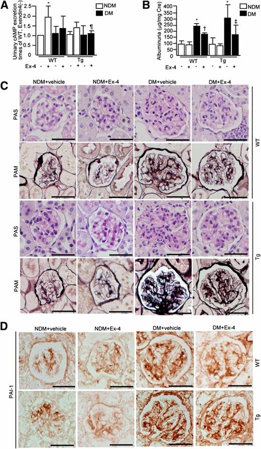 FIG. 4. Effect of exendin-4 (Ex-4) treatment in EC-PKCβ2Tg mice. A: Urinary cAMP excretions in each group are shown: mice with STZ-induced diabetes (DM), nondiabetic mice (NDM), WT mice, and EC-PKCβ2Tg mice. n = 6 in nondiabetic WT plus vehicle, nondiabetic WT plus exendin-4, diabetic WT plus vehicle, diabetic WT plus exendin-4, nondiabetic transgenic (Tg) plus exendin-4, and diabetic transgenic plus exendin-4; n = 7 in nondiabetic transgenic plus vehicle and diabetic transgenic plus vehicle. *P < 0.05 vs. WT/nondiabetic/exendin-4−; ¶P < 0.05 vs. WT/nondiabetic/exendin-4+. B: Albuminuria in each test group is shown. n = 6 in nondiabetic WT plus vehicle, nondiabetic WT plus exendin-4, diabetic WT plus vehicle, diabetic WT plus exendin-4, nondiabetic transgenic plus exendin-4, and diabetic transgenic plus exendin-4; n = 7 in nondiabetic transgenic plus vehicle and diabetic transgenic plus vehicle. *P < 0.05 vs. WT/nondiabetic/exendin-4−; †P < 0.05 vs. WT/diabetic/exendin-4−; ‡P < 0.05 vs. transgenic/diabetic/exendin-4−. C: Representative light microscopic appearance of glomeruli periodic acid–Schiff (PAS) and periodic acid–methenamine-silver (PAM) staining. Bar = 50 μm. n = 6 in nondiabetic WT plus vehicle, nondiabetic WT plus exendin-4, diabetic WT plus vehicle, diabetic WT plus exendin-4, nondiabetic transgenic plus exendin-4, and diabetic transgenic plus exendin-4; n = 7 in nondiabetic transgenic plus vehicle and diabetic transgenic plus vehicle. Magnification ×400. D: Immunostaining for PAI-1 in each group of mice is shown. Bar = 50 μm. n = 6 in nondiabetic WT plus vehicle, nondiabetic WT plus exendin-4, diabetic WT plus vehicle, diabetic WT plus exendin-4, nondiabetic transgenic plus exendin-4, and diabetic transgenic plus exendin-4; n = 7 in nondiabetic transgenic plus vehicle and diabetic transgenic plus vehicle. Magnification ×400. One of three independently performed experiments is shown. Results are expressed as means ± SD. Comparisons were made between groups using either two-sample and paired t tests for two-way comparisons or one-way ANOVA for multiple groups to establish statistically significant differences. (A high-quality digital representation of this figure is available in the online issue.)