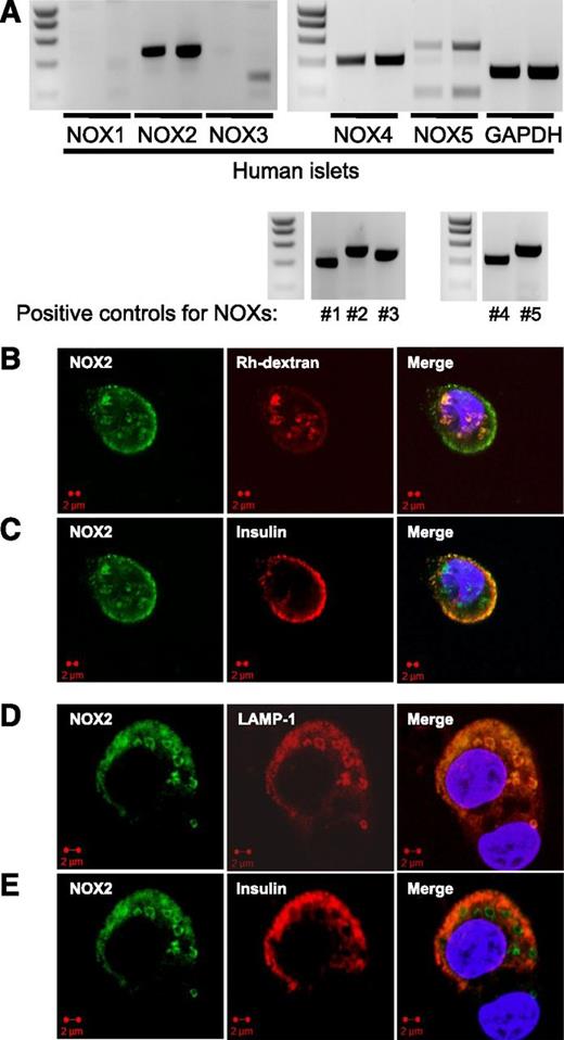FIG. 1. Gene expression of NOX components and NOX2 localization in human islets. A: Expression of catalytic NOX subunits in human islets (upper panel) was detected at the mRNA level by RT-PCR (for each gene, 35/40 cycles in the left and right lanes, respectively). Positive controls (lower panel) were performed on cDNA from human colon carcinoma cell line Caco-2 for NOX1 (#1), human neutrophils for NOX2 (#2), human embryonic kidney (HEK) cells transduced with human NOX3 gene (HEK-NOX3, #3), human microglia cell line clone 3 (HMC3) for NOX4 (#4), and HEK cells transduced with human NOX5 gene (HEK-NOX5, #5). B–E: Cellular localization by immunofluorescence of NOX2 (green) in β-cells from dissociated human islets combined with detection in red of rhodamine-conjugated dextran (Rh-dextran)-labeled early endosome (B) and insulin (C), late endosome and lysosome marker LAMP-1 (D), and insulin (E). Nuclei were stained in blue with DAPI. Fluorescence staining was performed with three independent batches of human pancreatic islet cells. GAPDH, glyceraldehyde-3-phosphate dehydrogenase. (A high-quality digital representation of this figure is available in the online issue.)